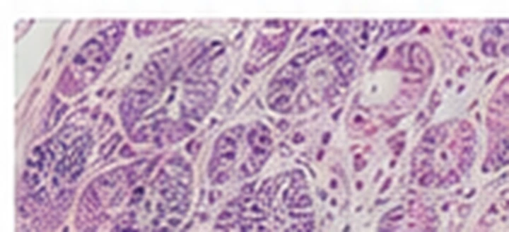 Purple-stained histology specimen under magnification